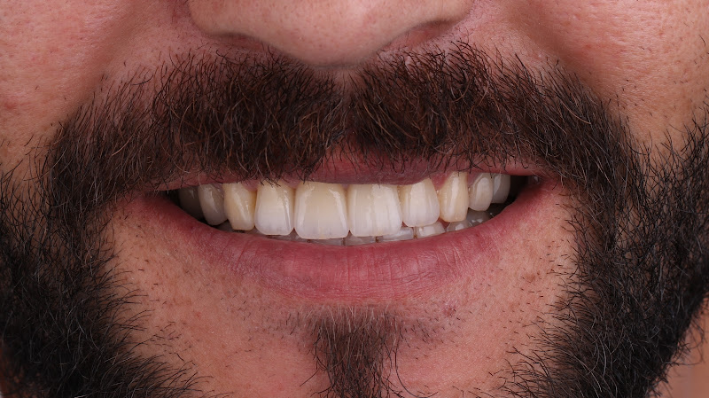 KERİMDENTAL Ağız ve diş sağılığı Polikliniği