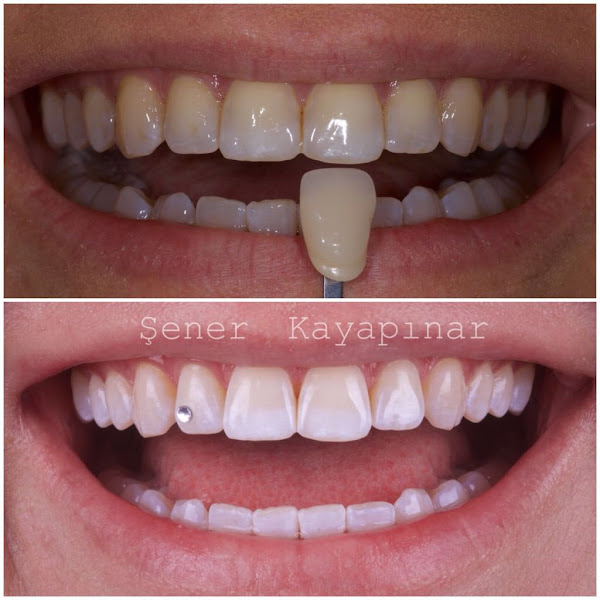 Lunadent Diyarbakır Ağız Ve Diş Sağlığı Polikliniği